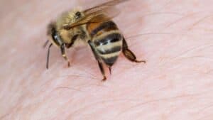 Arı Sokmasına Ne İyi Gelir?