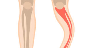 Paget Hastalığı: Belirtileri, Tedavisi ve Önleme Yöntemleri