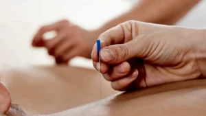 kuru-igne-tedavisi-nedir-neye-yarar